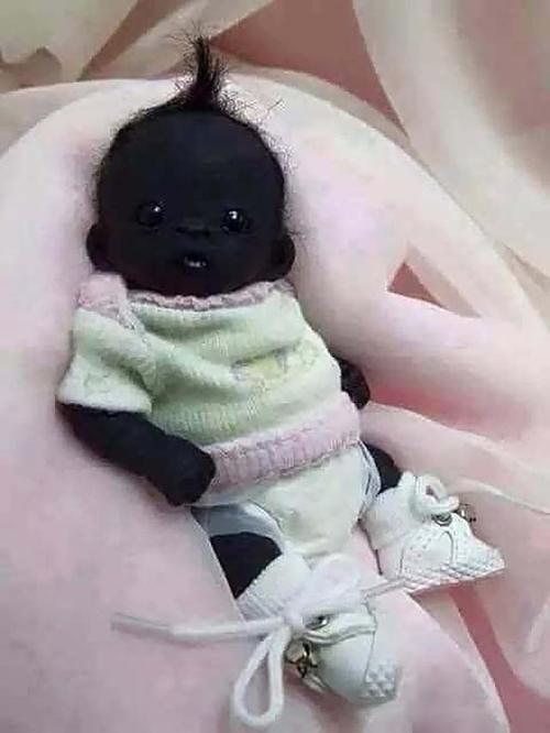 宝宝皮肤黑是什么原因的啊？宝宝有一岁多了现在皮肤还是很黑的？(宝宝越长越黑什么原因)