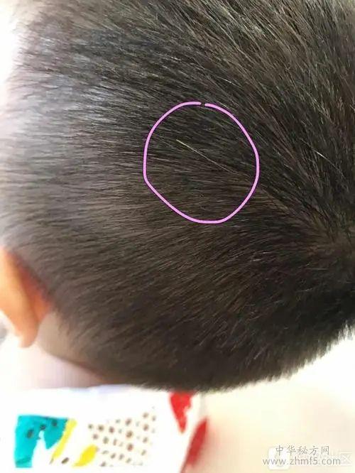 三岁宝宝头上有一根白头发是什么原因呢？(宝宝有白头发是缺什么)