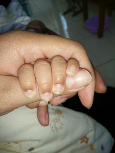 宝宝手指甲月牙部分发青发黑怎么回事？(宝宝变黑是缺什么原因)