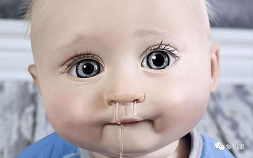 宝宝鼻子里的浓鼻涕如何弄出来？宝宝流浓鼻涕是什么原因