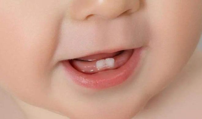 为什么宝宝只长一颗牙？宝宝出牙只出了一颗，这样是正常情况吗？宝宝长牙了 但是为什么会上长一颗下长一颗