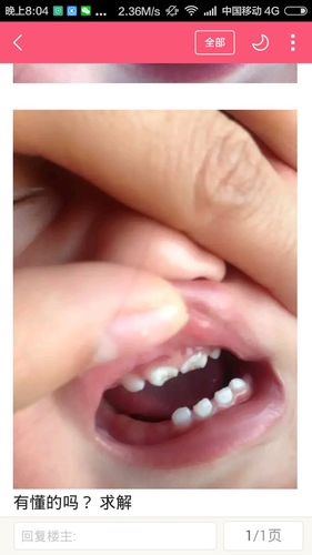 我家宝宝的牙齿上可以看到牙形这是什么意思？宝宝刚长出牙什么样子的