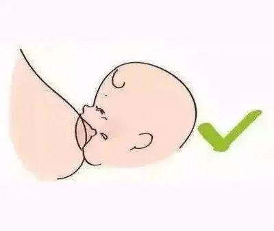 新生儿不愿意吸乳头，该怎么办？为什么宝宝拒绝乳头