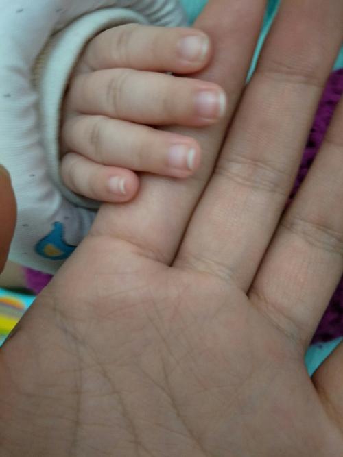 孩子的指甲颜色是白色的，这没问题吧？（宝宝指甲中间有白色的是什么颜色的）