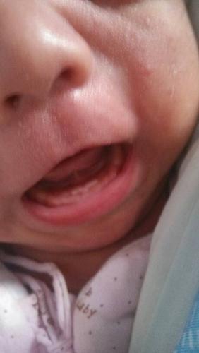 八个月的宝宝还没出牙，但牙龈发黑，是怎么回事呢？（宝宝长牙就变黑怎么回事吃什么药好）