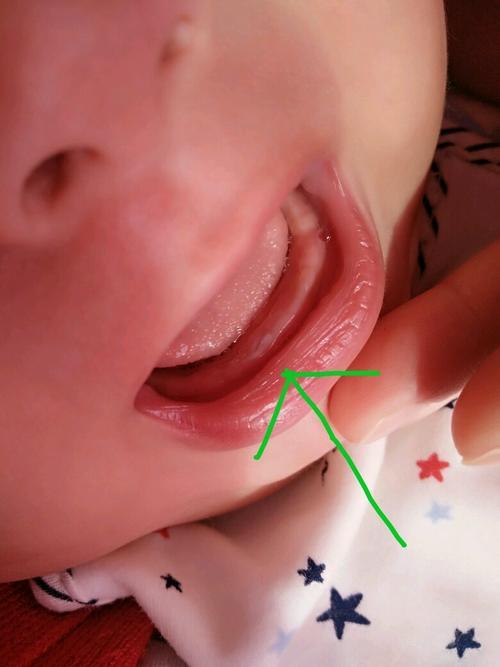 婴儿八个月不长牙怎么办？（宝宝8个月还不长牙 什么原因）