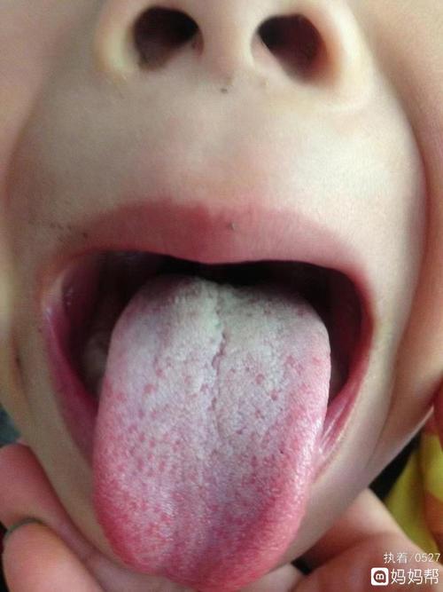 3岁孩子舌头上有白色舌苔，口气很臭怎么办呢？是消化不好吗？（三岁宝宝舌头白有舌苔怎么回事吃什么药）