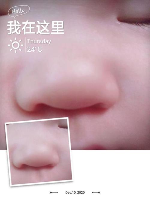 宝宝第八天鼻子里有鼻屎怎样处理？（八个月宝宝为什么鼻屎特多）